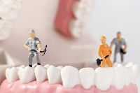 【健康解碼】洗牙會損害牙齒嗎？